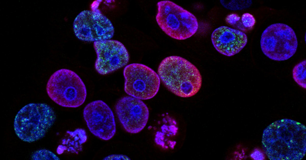 Biomedicina Forense: O Que Faz, Como Atuar e Mercado de Trabalho